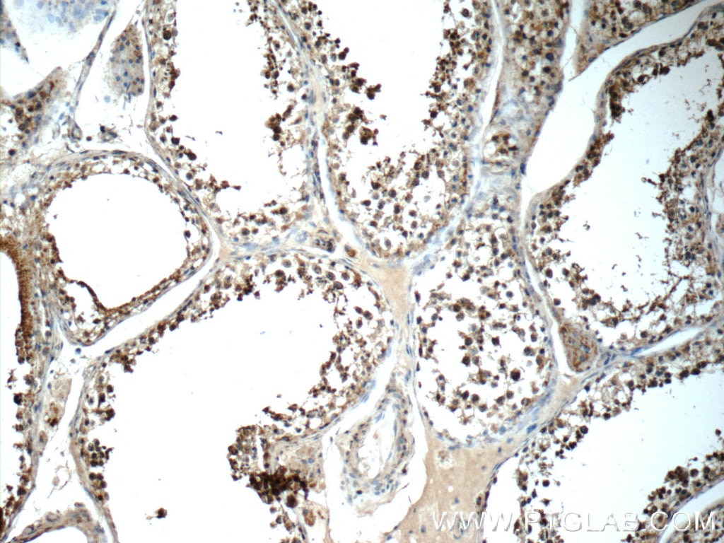 Immunohistochemistry (IHC) staining of human testis tissue using SCRG1 Polyclonal antibody (14038-1-AP)