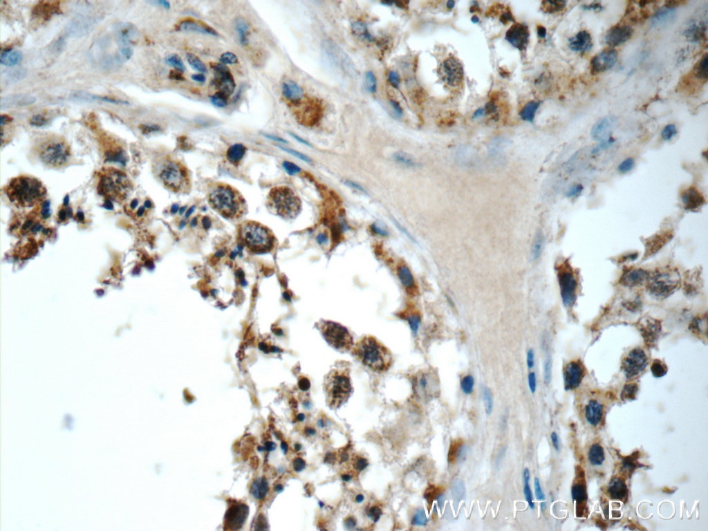 Immunohistochemistry (IHC) staining of human testis tissue using SCRG1 Polyclonal antibody (14038-1-AP)