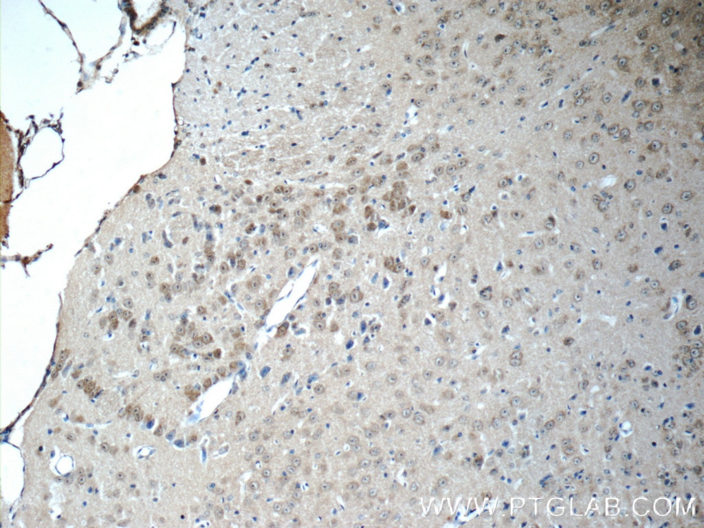 Immunohistochemistry (IHC) staining of mouse brain tissue using SCRG1 Polyclonal antibody (14038-1-AP)