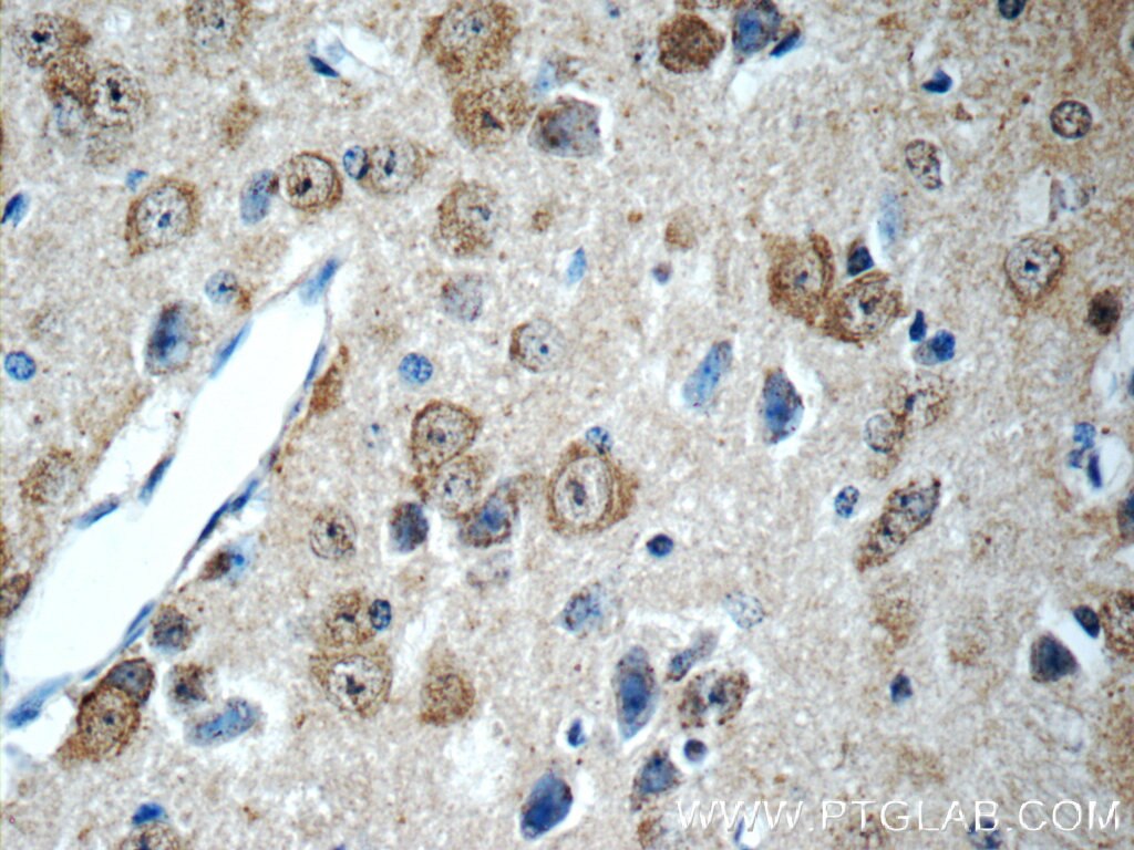 Immunohistochemistry (IHC) staining of mouse brain tissue using SCRG1 Polyclonal antibody (14038-1-AP)