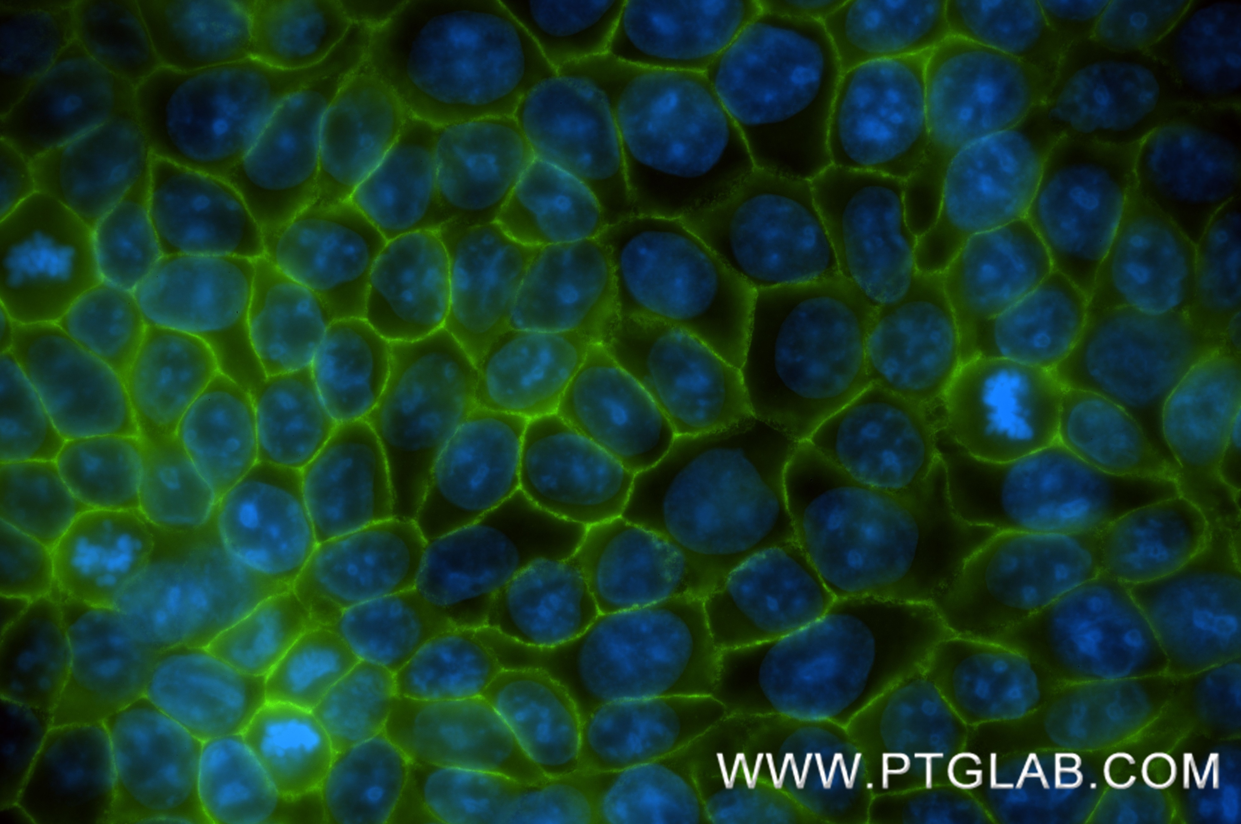 IF Staining of MCF-7 using 87069-3-RR (same clone as 87069-3-PBS) Immunofluorescence (IF) / fluorescent staining of MCF-7 cells using SCRIB Recombinant monoclonal antibody (87069-3-RR)