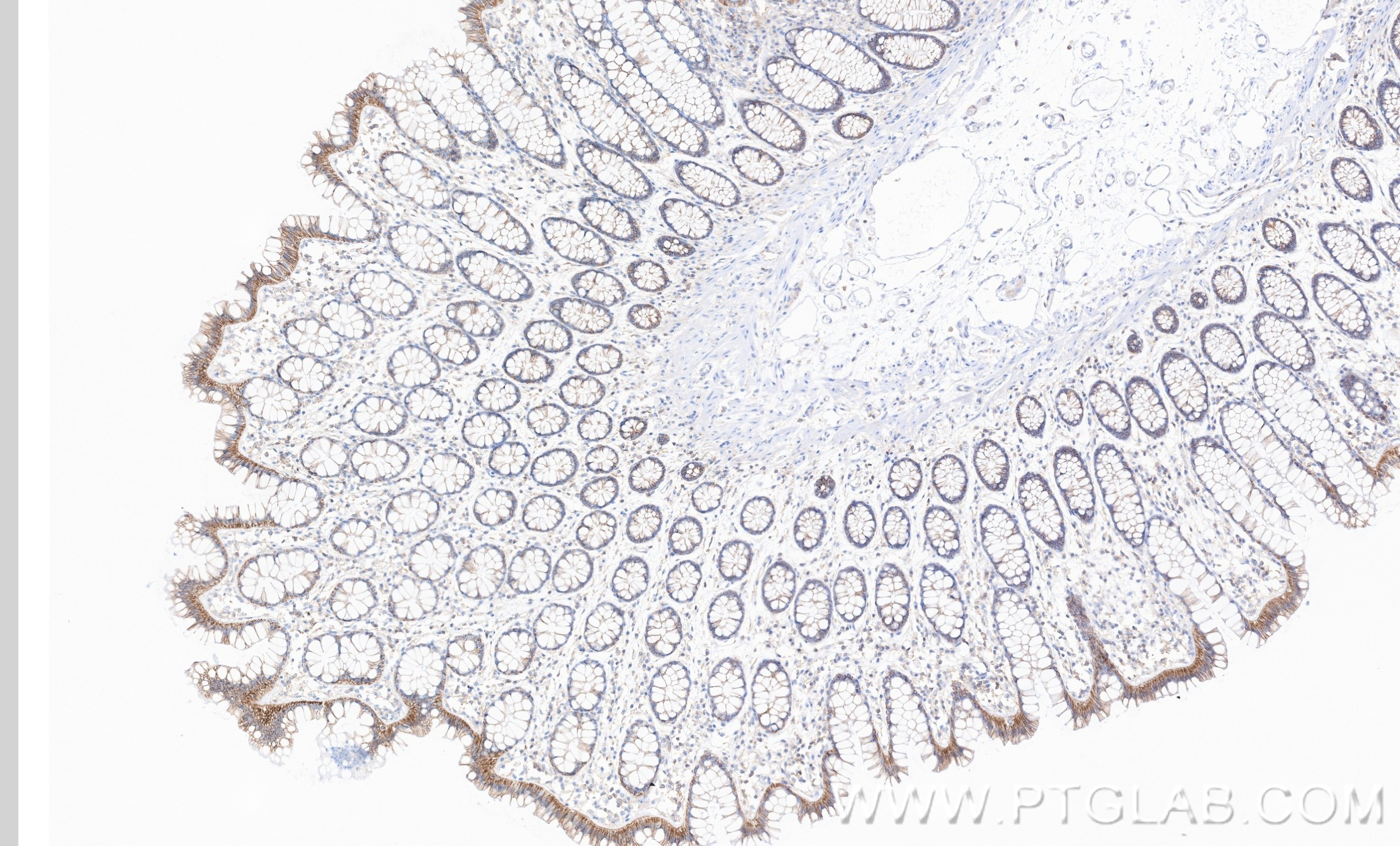 IHC staining of human large intestine using 87069-3-RR (same clone as 87069-3-PBS) Immunohistochemistry (IHC) staining of human large intestine tissue using SCRIB Recombinant monoclonal antibody (87069-3-RR)