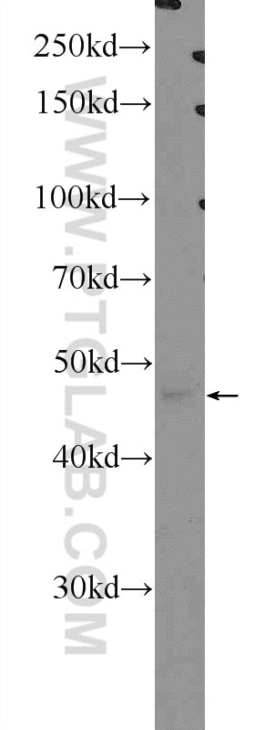 WB analysis of HeLa using 14303-1-AP