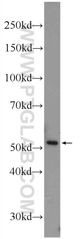 Western Blot (WB) analysis of A549 cells using SCRN1 Polyclonal antibody (14303-1-AP)