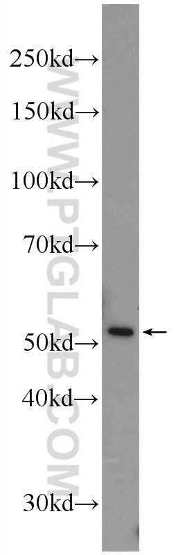 Western Blot (WB) analysis of A549 cells using SCRN1 Polyclonal antibody (14303-1-AP)