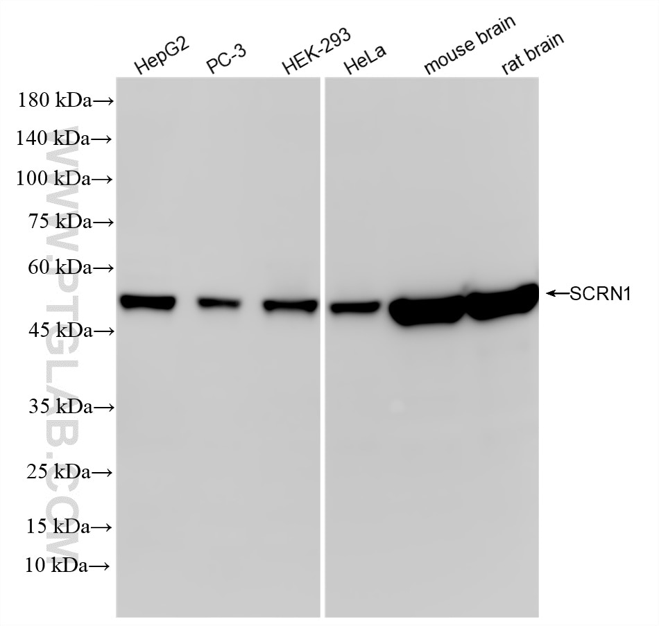 Western Blot (WB) analysis of various lysates using SCRN1 Recombinant monoclonal antibody (86646-1-RR)