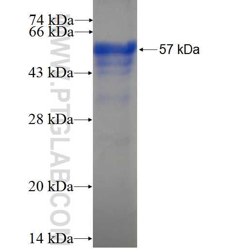 SCRN1 fusion protein Ag5413 SDS-PAGE