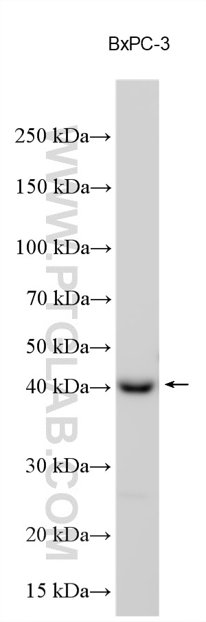Western Blot (WB) analysis of various lysates using SCRN2 Polyclonal antibody (11485-2-AP)