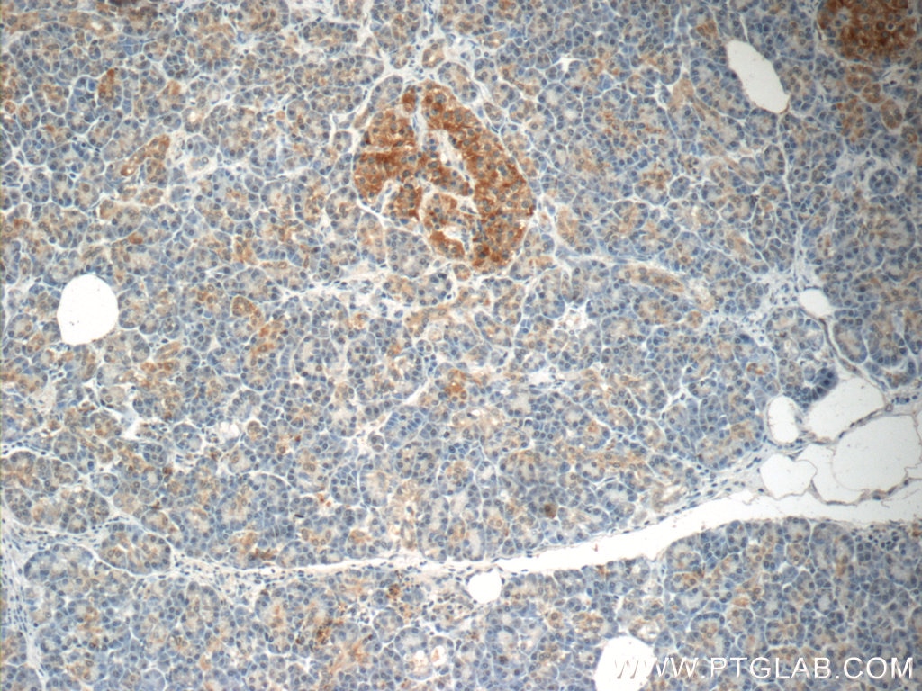 Immunohistochemistry (IHC) staining of human pancreas tissue using SCRN3 Polyclonal antibody (13240-1-AP)