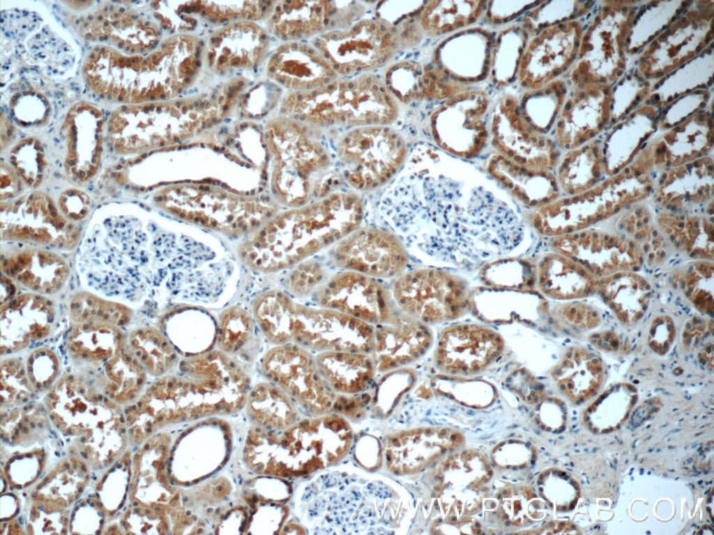 IHC staining of human kidney using 13240-1-AP