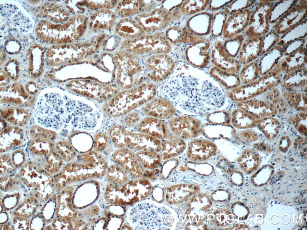 Immunohistochemistry (IHC) staining of human kidney tissue using SCRN3 Polyclonal antibody (13240-1-AP)