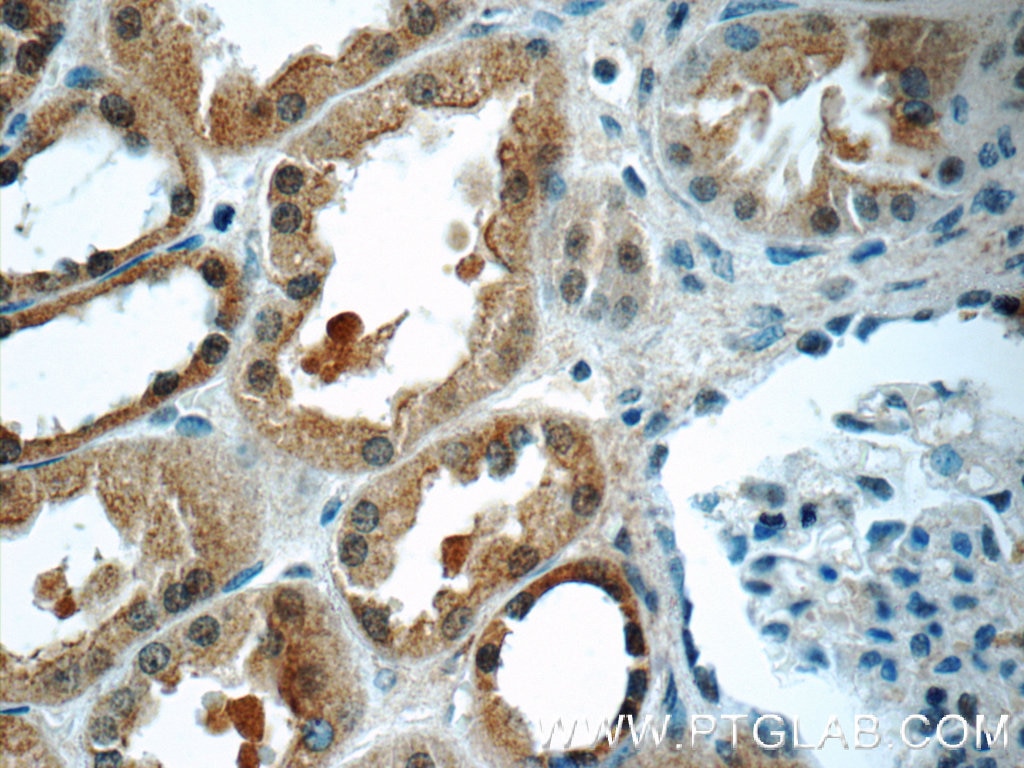 Immunohistochemistry (IHC) staining of human kidney tissue using SCRN3 Polyclonal antibody (13240-1-AP)