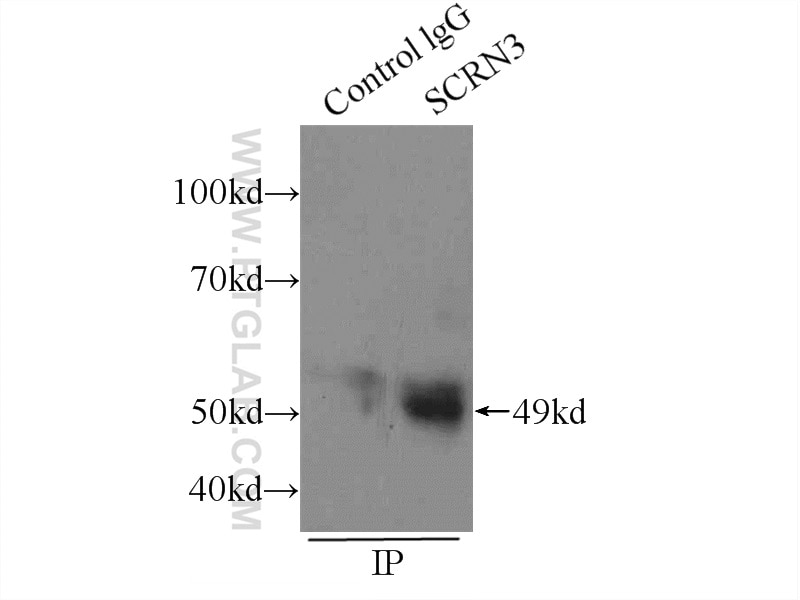 Immunoprecipitation (IP) experiment of HEK-293 cells using SCRN3 Polyclonal antibody (13240-1-AP)