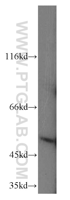 Western Blot (WB) analysis of A549 cells using SCRN3 Polyclonal antibody (13240-1-AP)