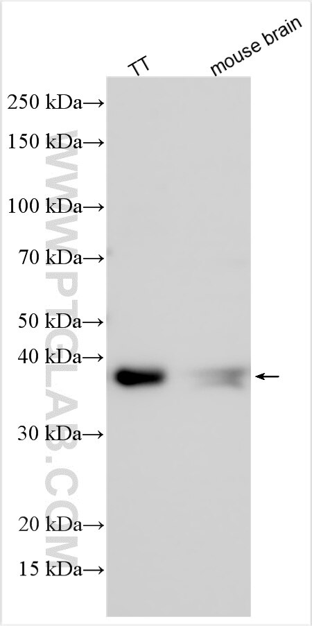 Western Blot (WB) analysis of various lysates using SCRT1 Polyclonal antibody (31577-1-AP)