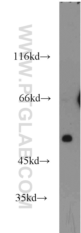 Western Blot (WB) analysis of mouse pancreas tissue using SCTR Polyclonal antibody (14172-1-AP)