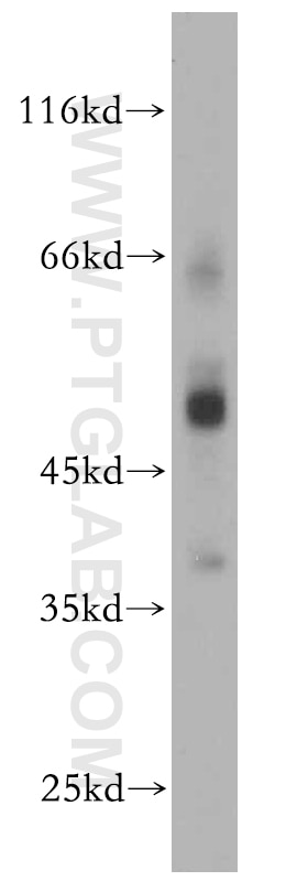 Western Blot (WB) analysis of mouse pancreas tissue using SCTR Polyclonal antibody (14172-1-AP)