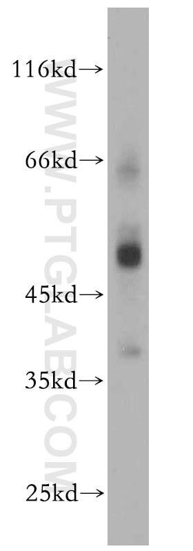 WB analysis of mouse pancreas using 14172-1-AP