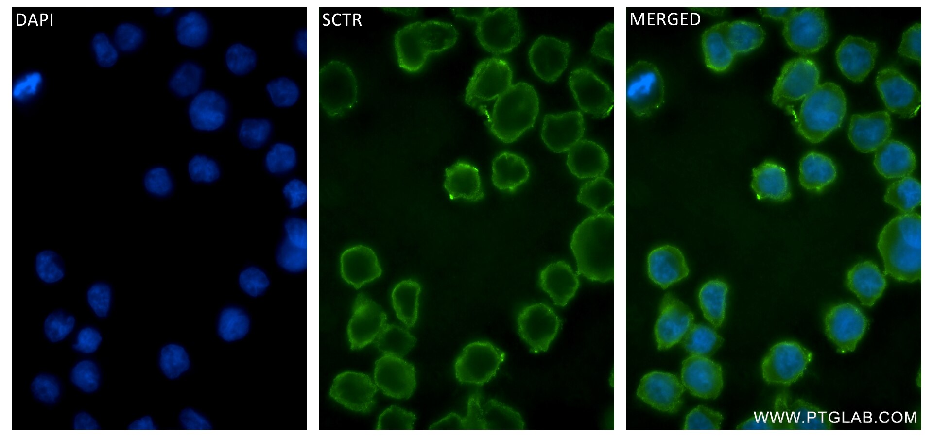 Immunofluorescence (IF) / fluorescent staining of THP-1 cells using SCTR Recombinant antibody (83675-6-RR)