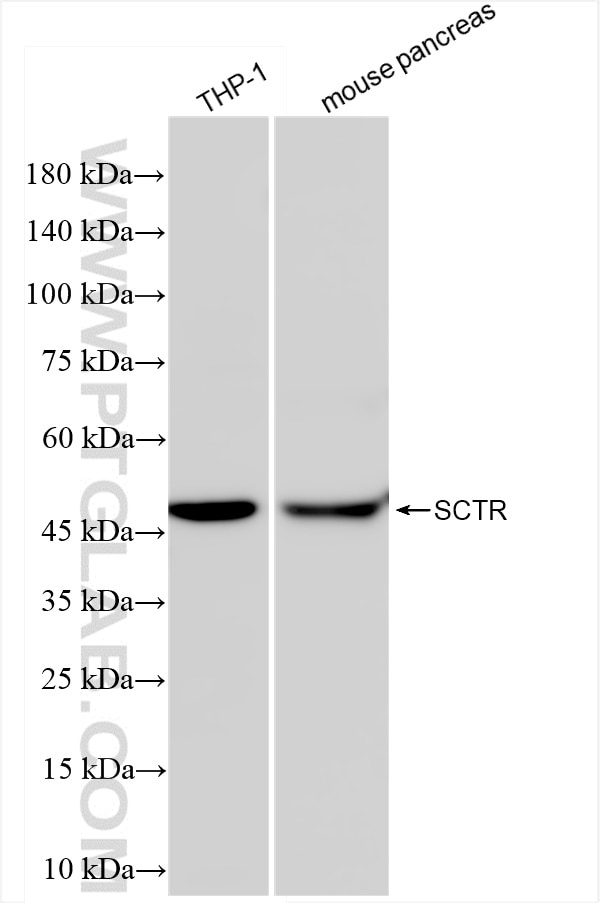 Western Blot (WB) analysis of various lysates using SCTR Recombinant antibody (83675-6-RR)
