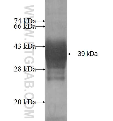 SCTR fusion protein Ag5371 SDS-PAGE