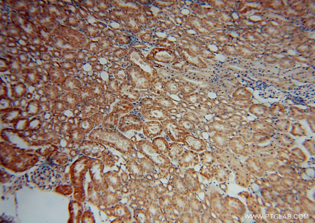 Immunohistochemistry (IHC) staining of human kidney tissue using SCUBE3 Polyclonal antibody (16773-1-AP)