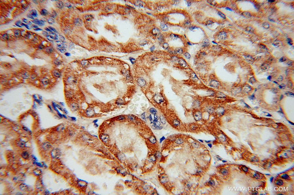 Immunohistochemistry (IHC) staining of human kidney tissue using SCUBE3 Polyclonal antibody (16773-1-AP)