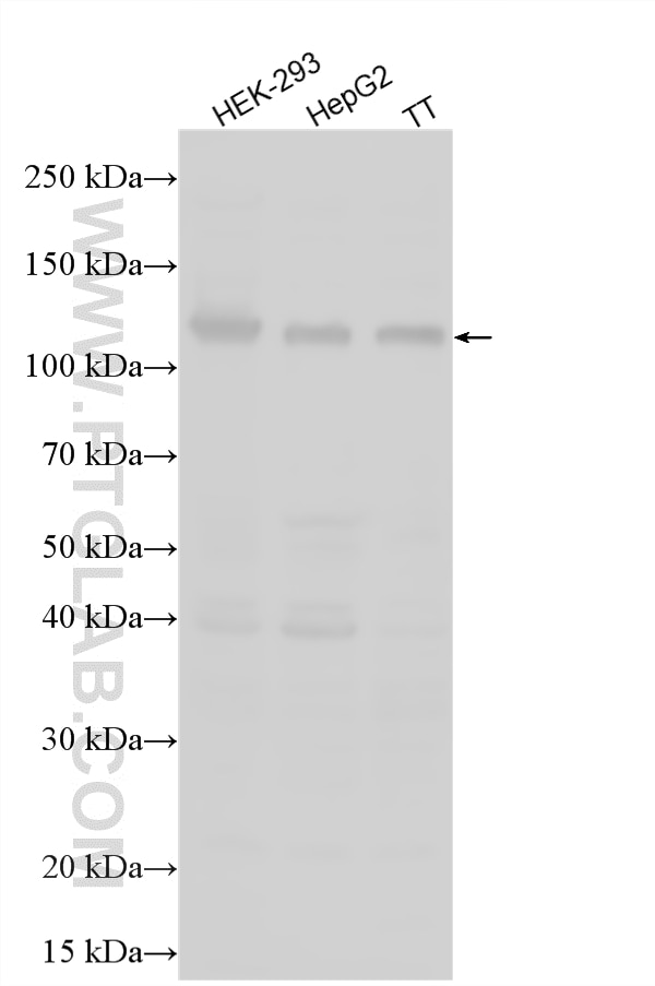 Western Blot (WB) analysis of various lysates using SCUBE3 Polyclonal antibody (16773-1-AP)