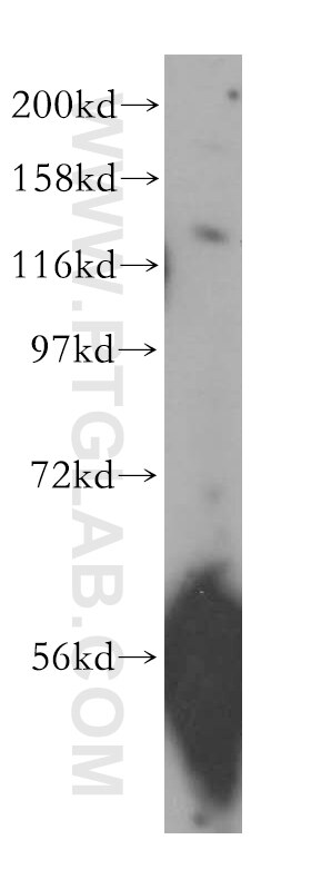 Western Blot (WB) analysis of mouse lung tissue using SCUBE3 Polyclonal antibody (16773-1-AP)