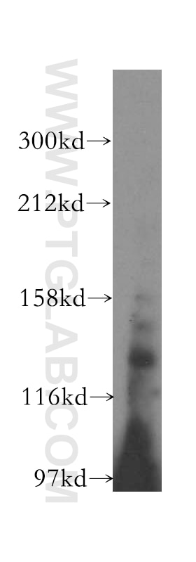 Western Blot (WB) analysis of mouse kidney tissue using SCUBE3 Polyclonal antibody (16773-1-AP)
