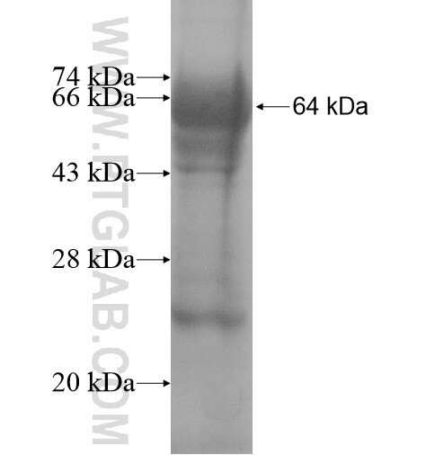 SCUBE3 fusion protein Ag10085 SDS-PAGE