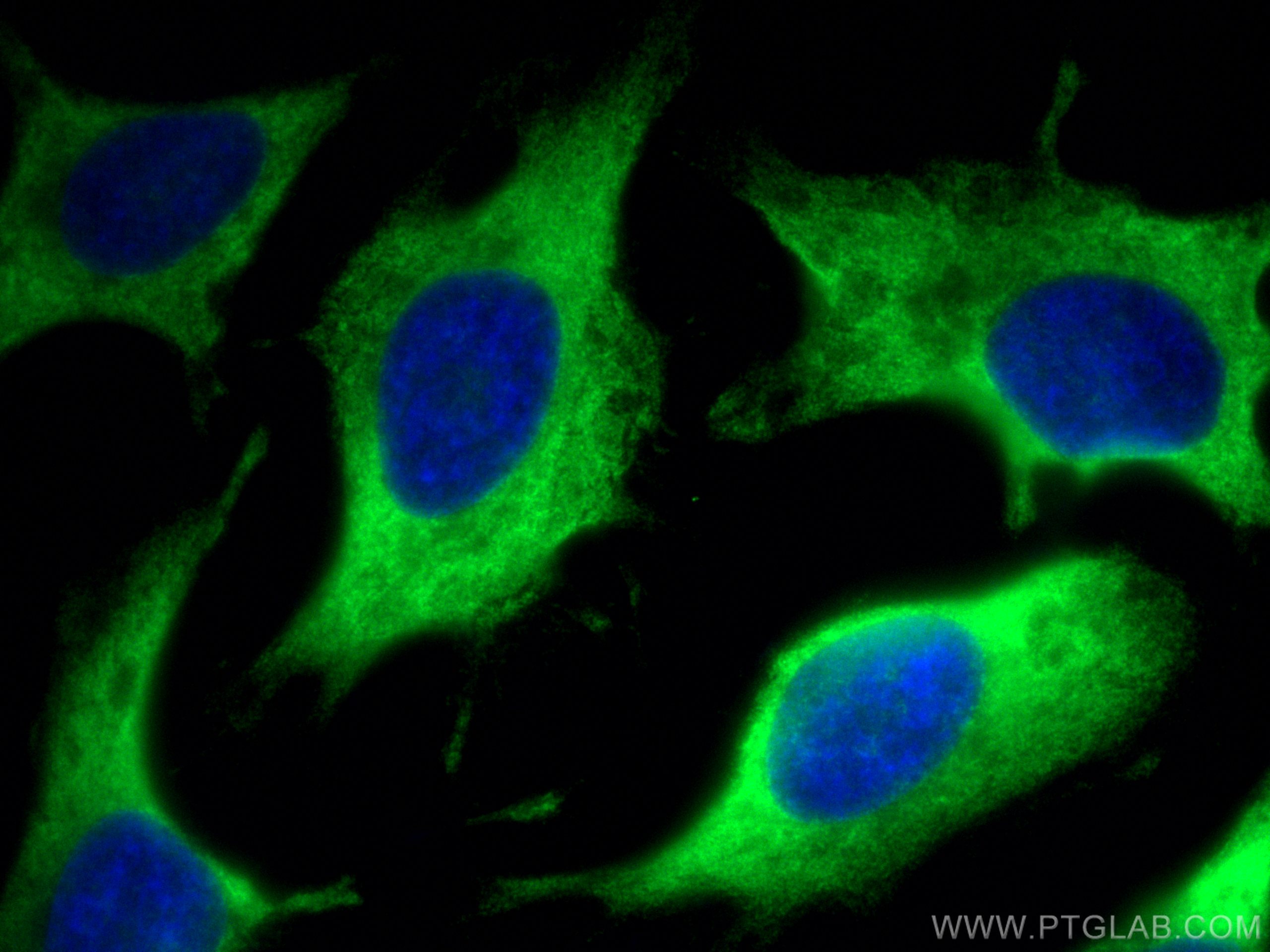 Immunofluorescence (IF) / fluorescent staining of HeLa cells using EMAP II Polyclonal antibody (11091-1-AP)