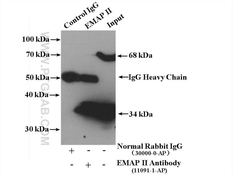 Immunoprecipitation (IP) experiment of SGC-7901 cells using EMAP II Polyclonal antibody (11091-1-AP)