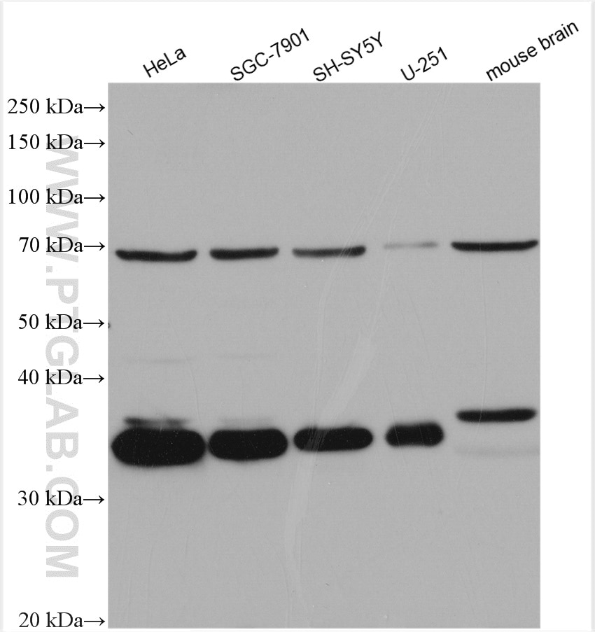 Western Blot (WB) analysis of various lysates using EMAP II Polyclonal antibody (11091-1-AP)