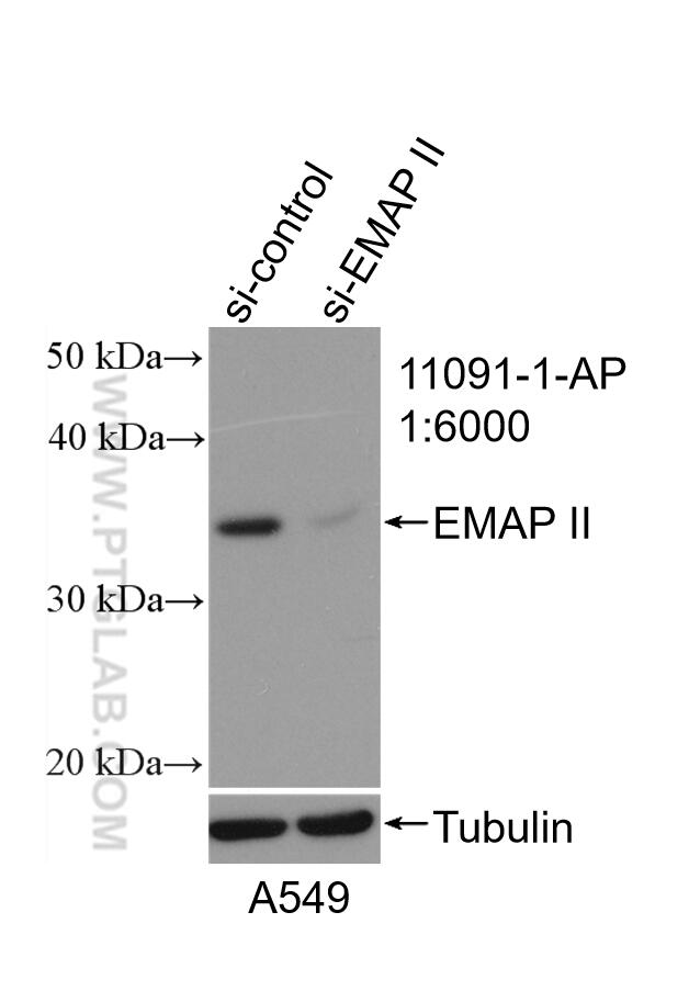 Western Blot (WB) analysis of A549 cells using EMAP II Polyclonal antibody (11091-1-AP)