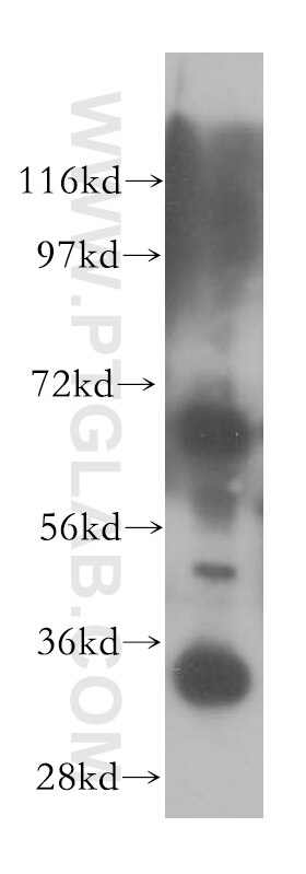 EMAP II Polyclonal antibody