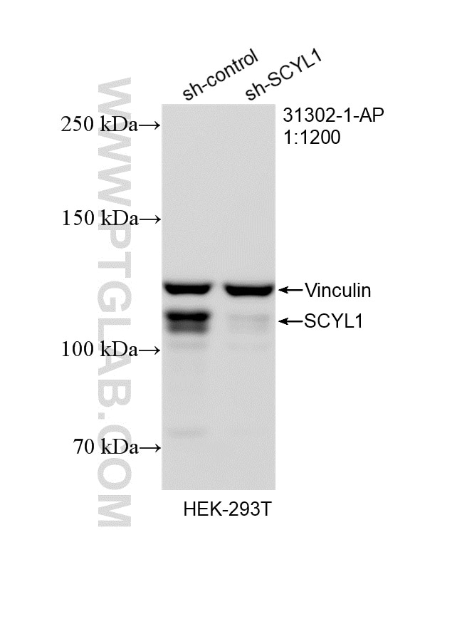 WB result of SCYL1 antibody (31302-1-AP; 1:1200; incubated at room temperature for 1.5 hours) with sh-Control and sh-SCYL1 transfected HEK-293T cells. Western Blot (WB) analysis of HEK-293T cells using SCYL1 Polyclonal antibody (31302-1-AP)