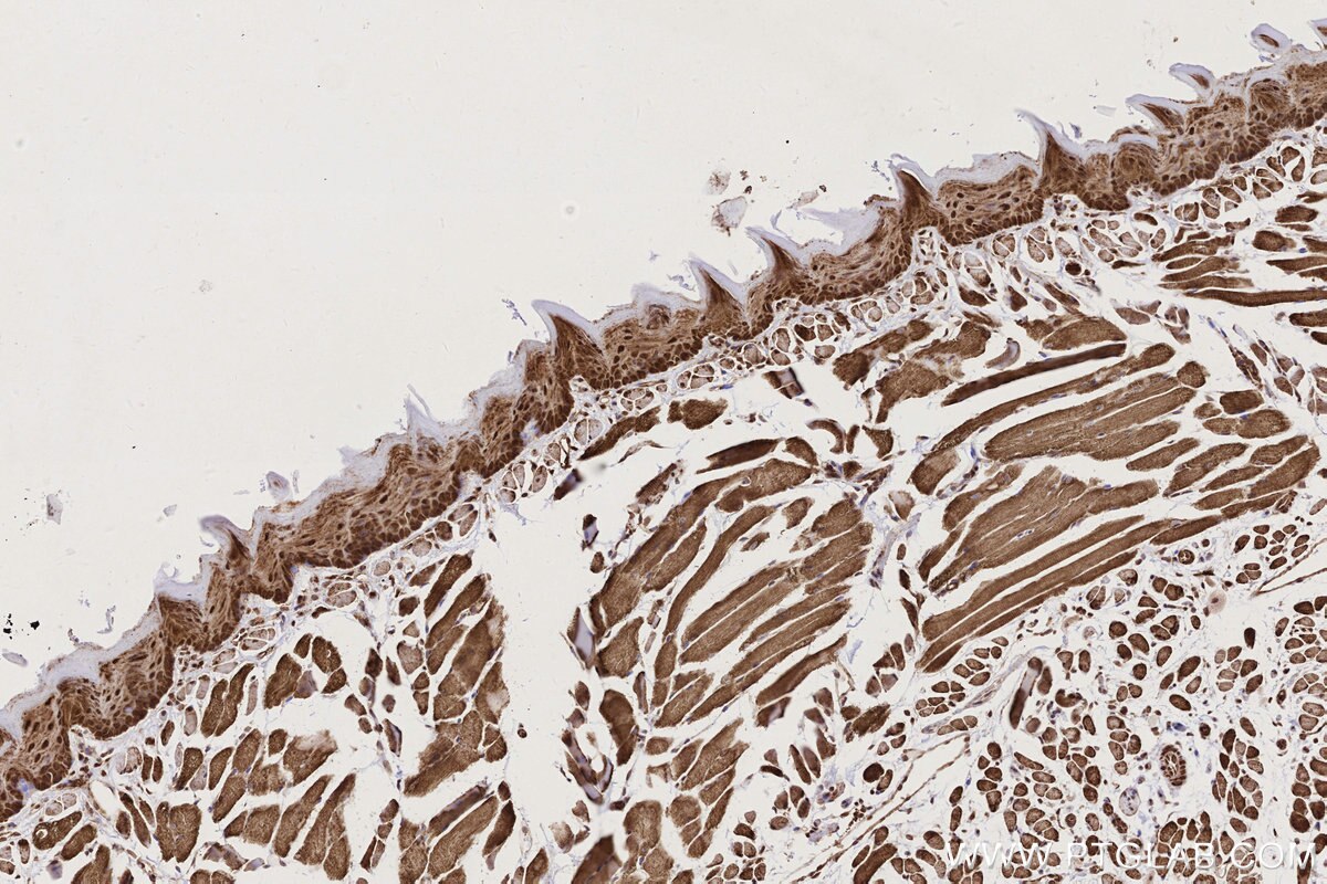 IHC staining of mouse tongue using 84561-2-RR Immunohistochemistry (IHC) staining of mouse tongue tissue using SCYL1 Recombinant monoclonal antibody (84561-2-RR)