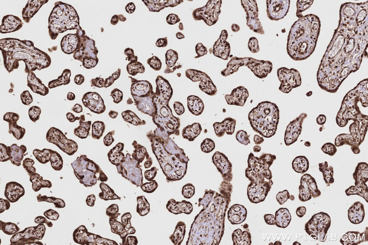 IHC staining of human placenta using 84561-2-RR Immunohistochemistry (IHC) staining of human placenta tissue using SCYL1 Recombinant monoclonal antibody (84561-2-RR)