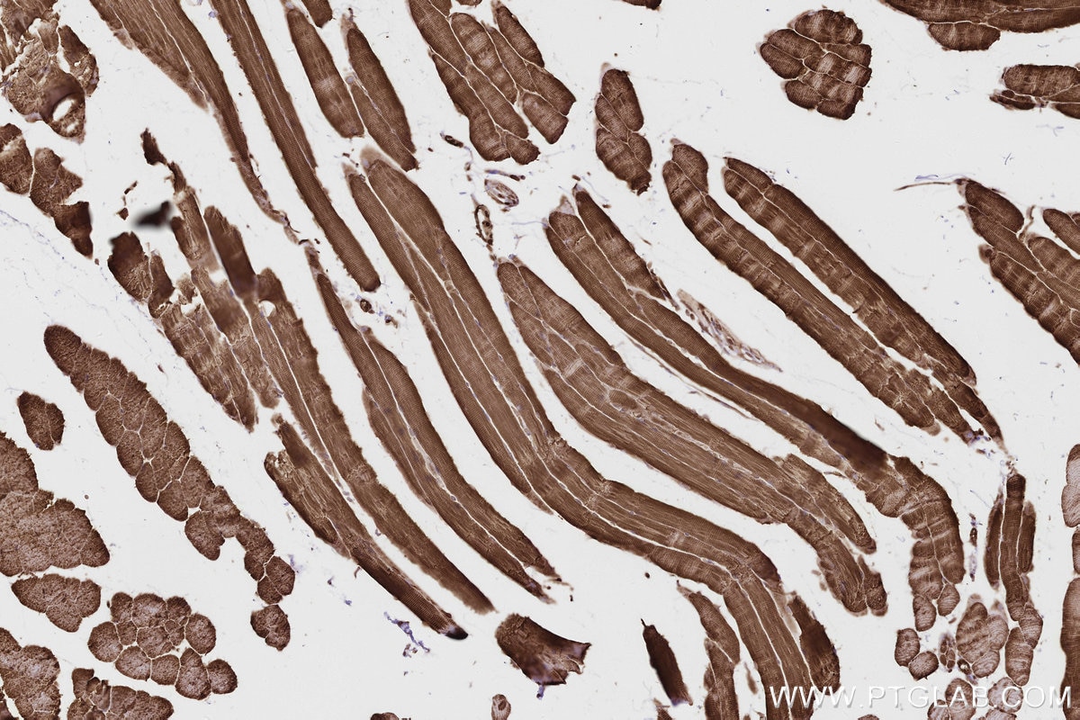 IHC staining of mouse skeletal muscle using 84561-2-RR Immunohistochemistry (IHC) staining of mouse skeletal muscle tissue using SCYL1 Recombinant monoclonal antibody (84561-2-RR)