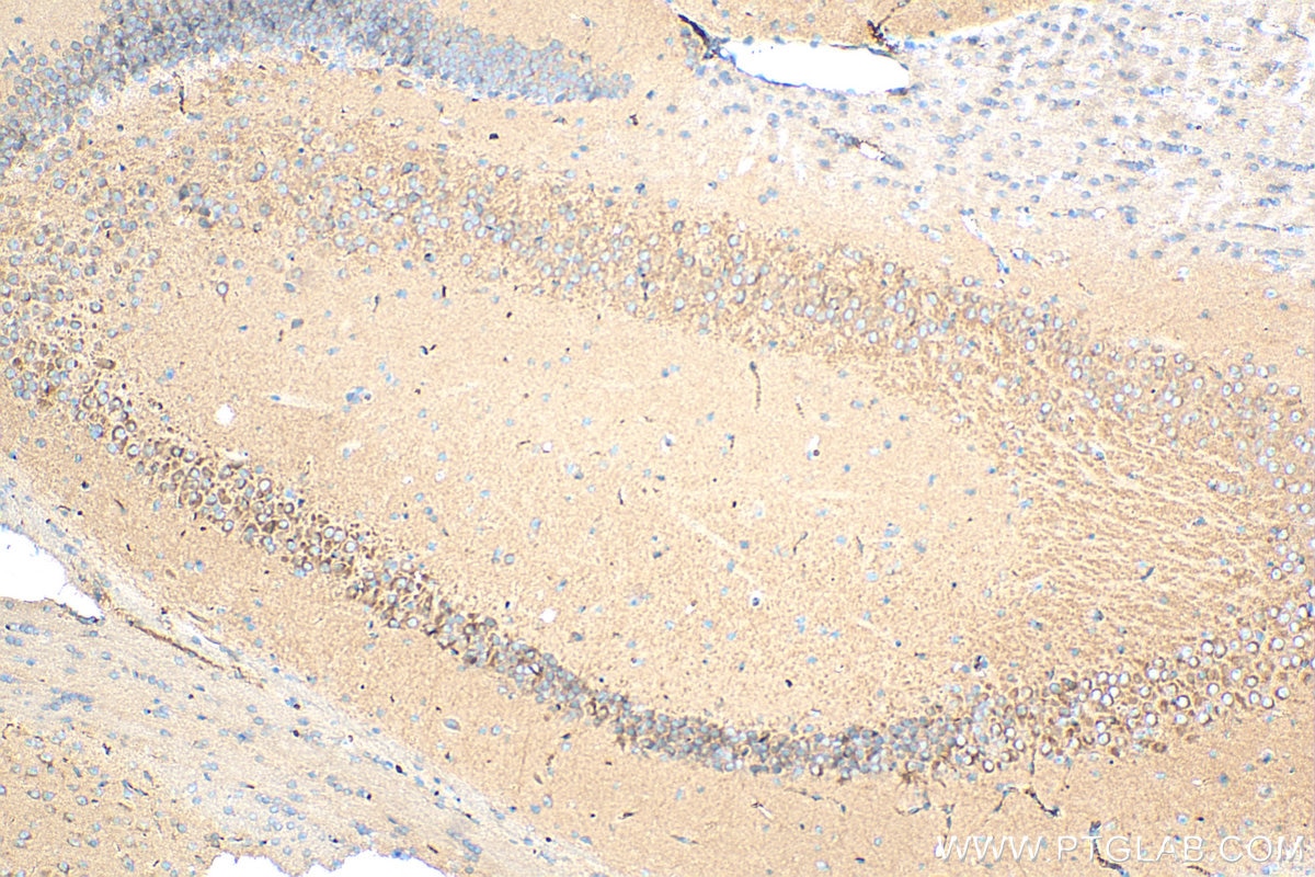 Immunohistochemistry (IHC) staining of mouse brain tissue using SCYL2 Polyclonal antibody (12325-1-AP)