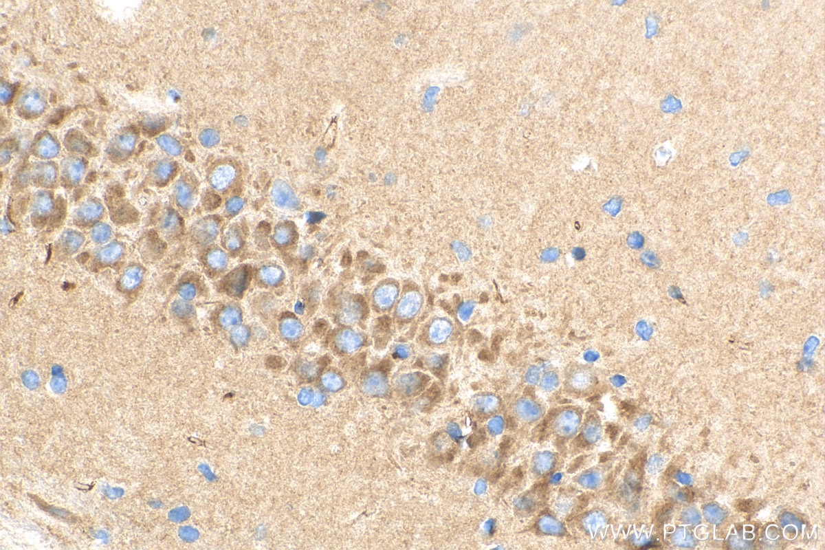 Immunohistochemistry (IHC) staining of mouse brain tissue using SCYL2 Polyclonal antibody (12325-1-AP)