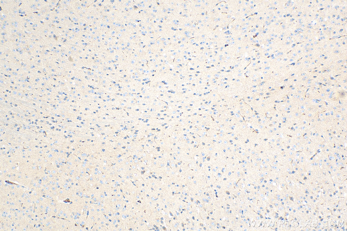 Immunohistochemistry (IHC) staining of mouse cerebellum tissue using SCYL2 Polyclonal antibody (12325-1-AP)