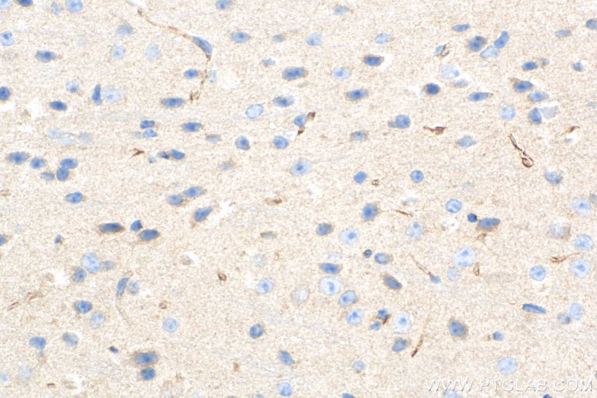 Immunohistochemistry (IHC) staining of mouse cerebellum tissue using SCYL2 Polyclonal antibody (12325-1-AP)