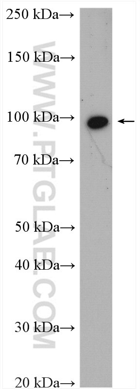Western Blot (WB) analysis of HEK-293T cells using SCYL2 Polyclonal antibody (12325-1-AP)