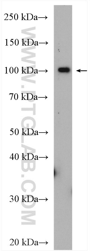 Western Blot (WB) analysis of HepG2 cells using SCYL2 Polyclonal antibody (12325-1-AP)
