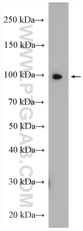 Western Blot (WB) analysis of HeLa cells using SCYL2 Polyclonal antibody (12325-1-AP)