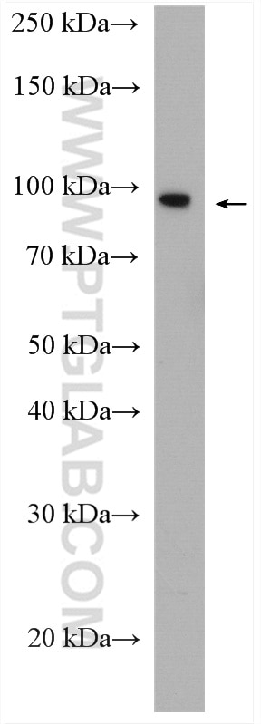 Western Blot (WB) analysis of Jurkat cells using SCYL2 Polyclonal antibody (12325-1-AP)