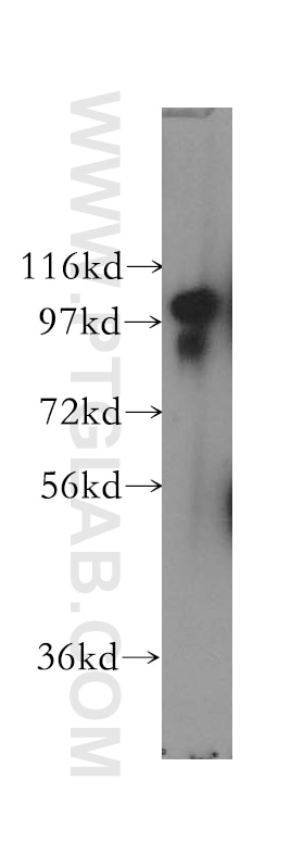 Western Blot (WB) analysis of NIH/3T3 cells using SCYL2 Polyclonal antibody (12325-1-AP)