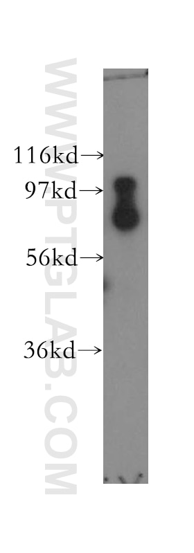 Western Blot (WB) analysis of mouse uterus tissue using SCYL2 Polyclonal antibody (12325-1-AP)